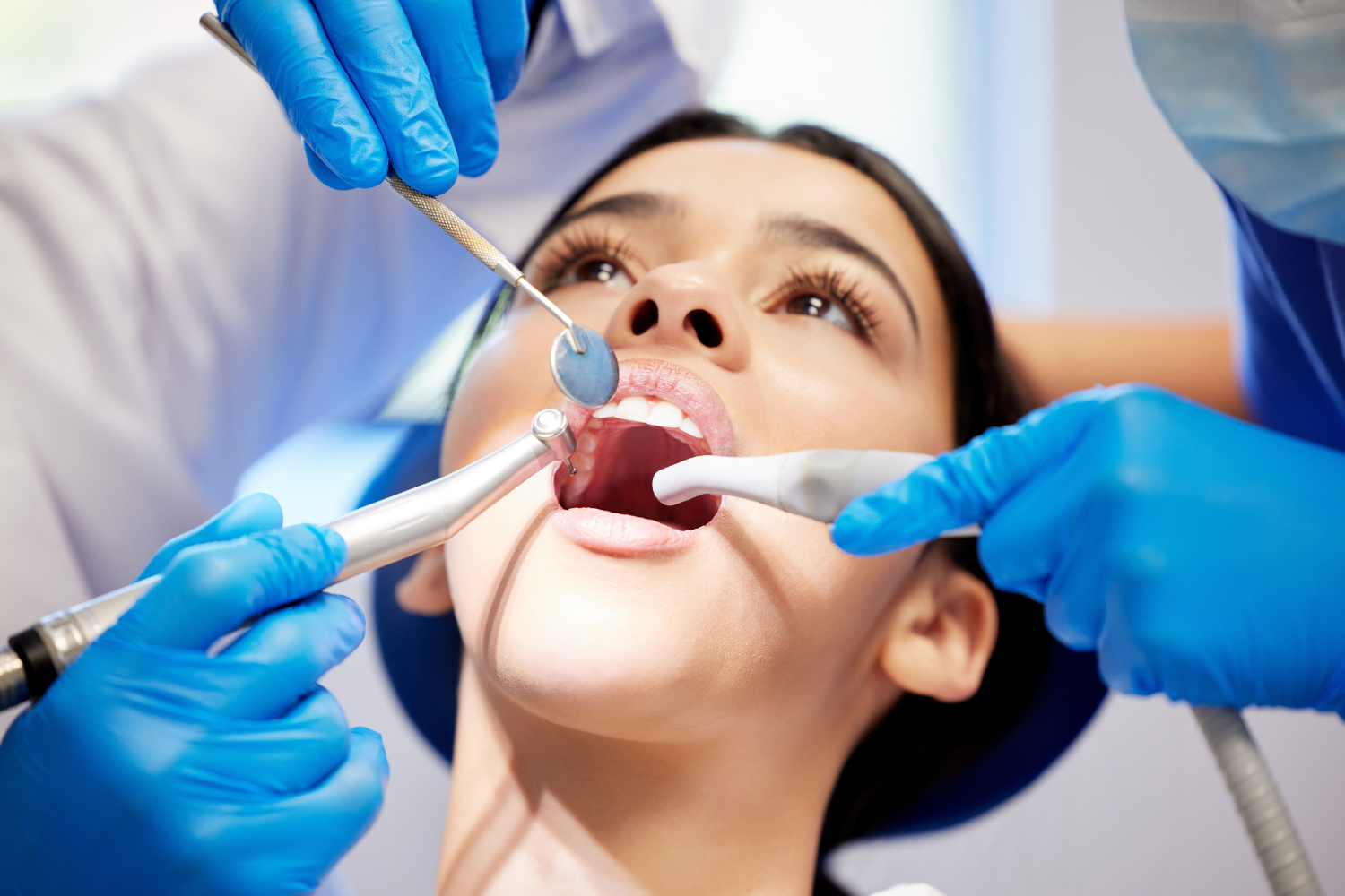 Dental Cleaning vs Deep Cleaning: Understanding the Difference for Long-Term Gum Health