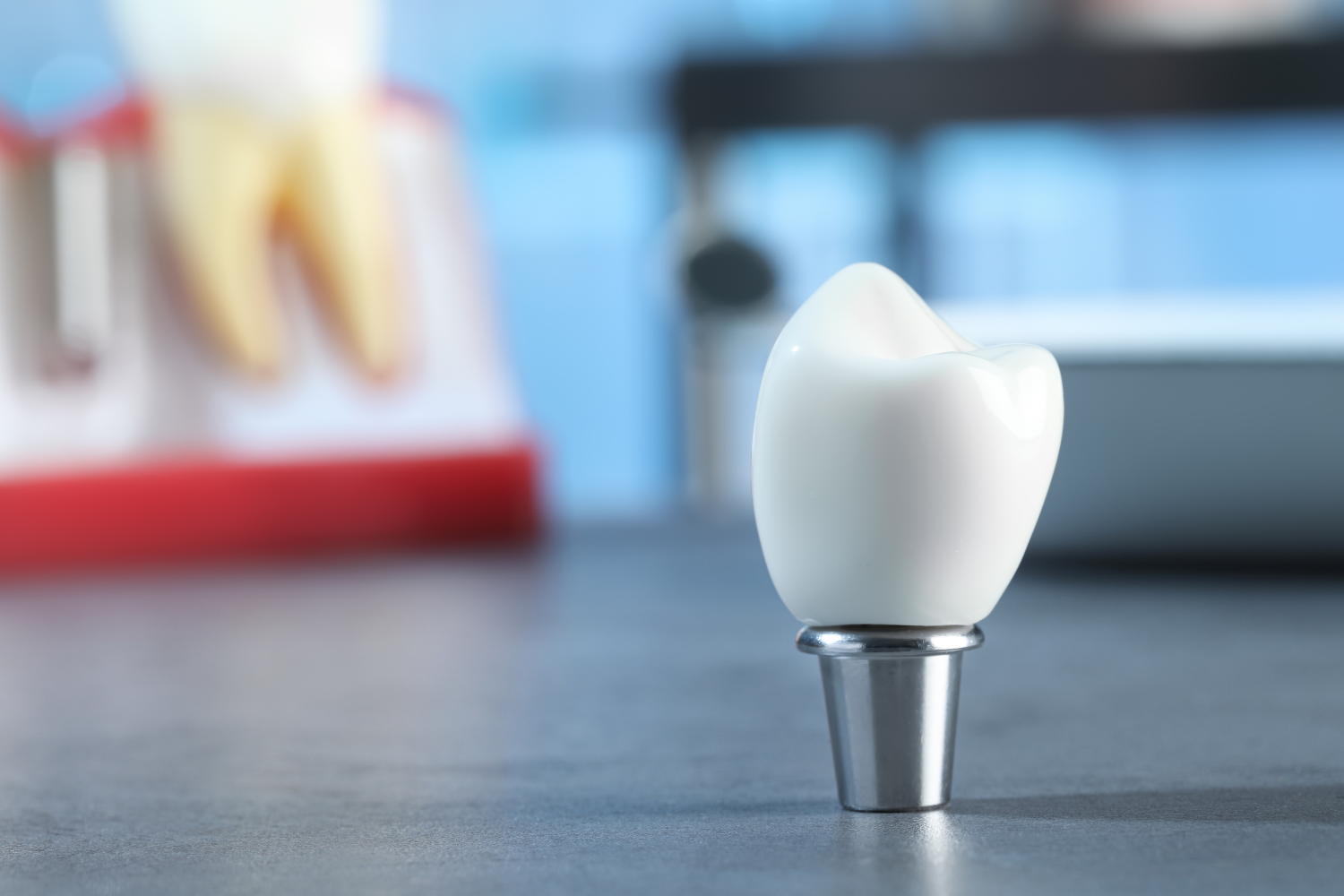 Single-Tooth Implants: What Patients Should Expect From Start to Finish