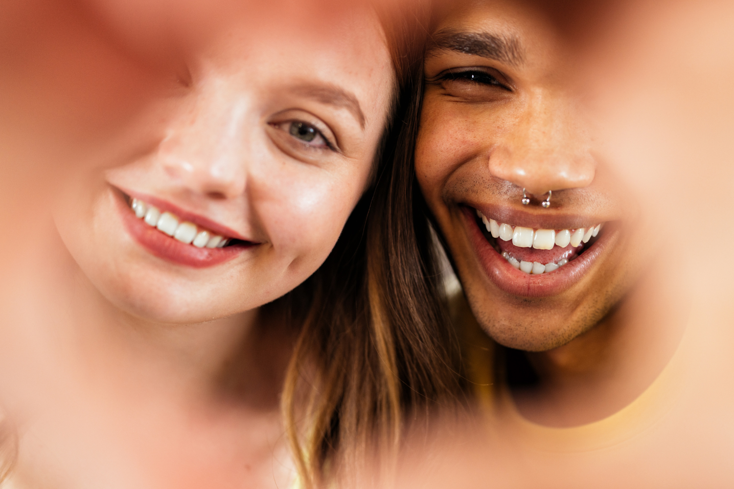 Veneers vs Bonding: Understanding the Best Option for a Natural Smile