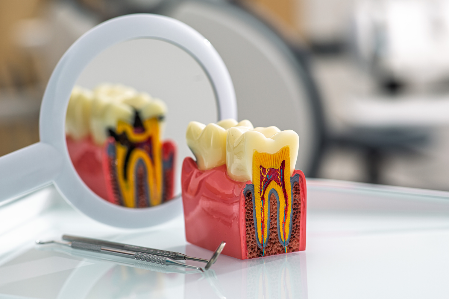How Long Do Dental Fillings Last? What Affects Their Longevity