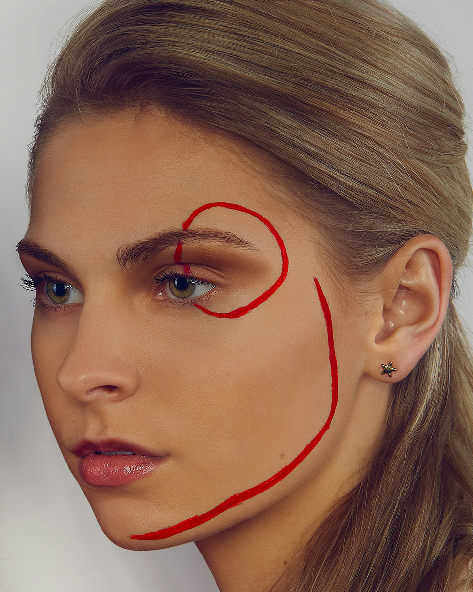 Refreshed natural Botox results around the eyes