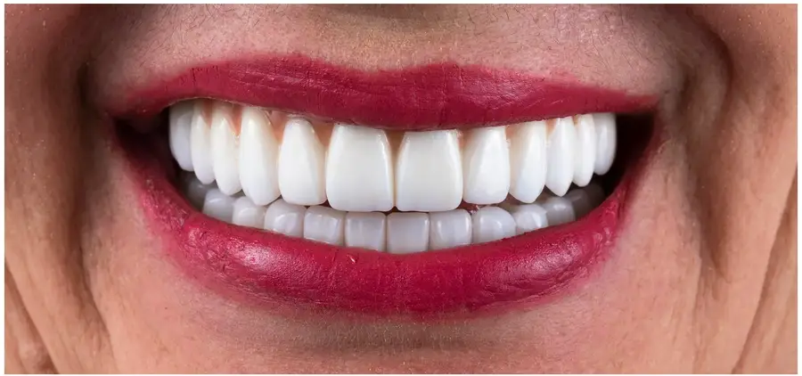 Close-up of a smiling mouth with bright white teeth and red lipstick on lips.