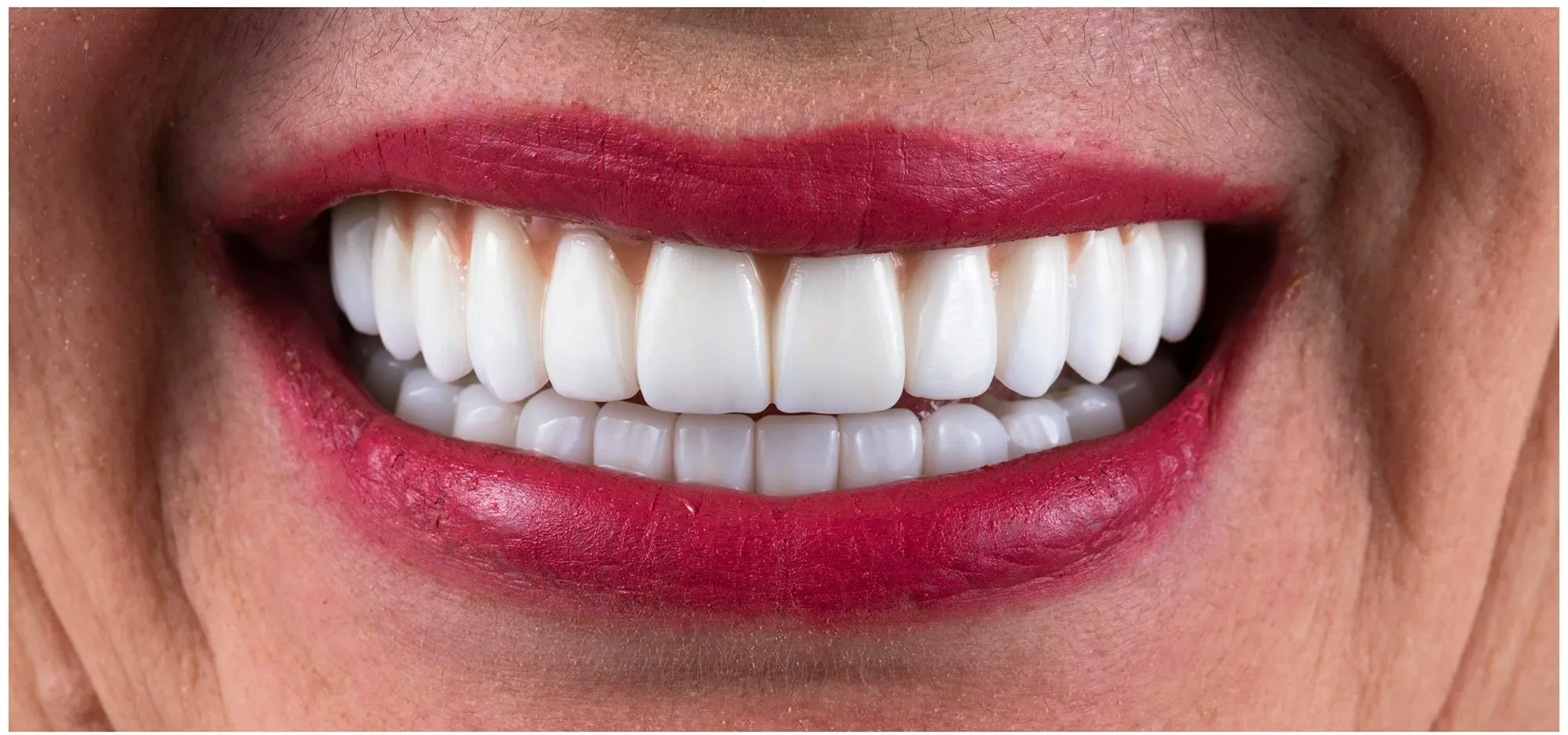 Close-up of a smiling mouth with bright white teeth and red lipstick on lips.