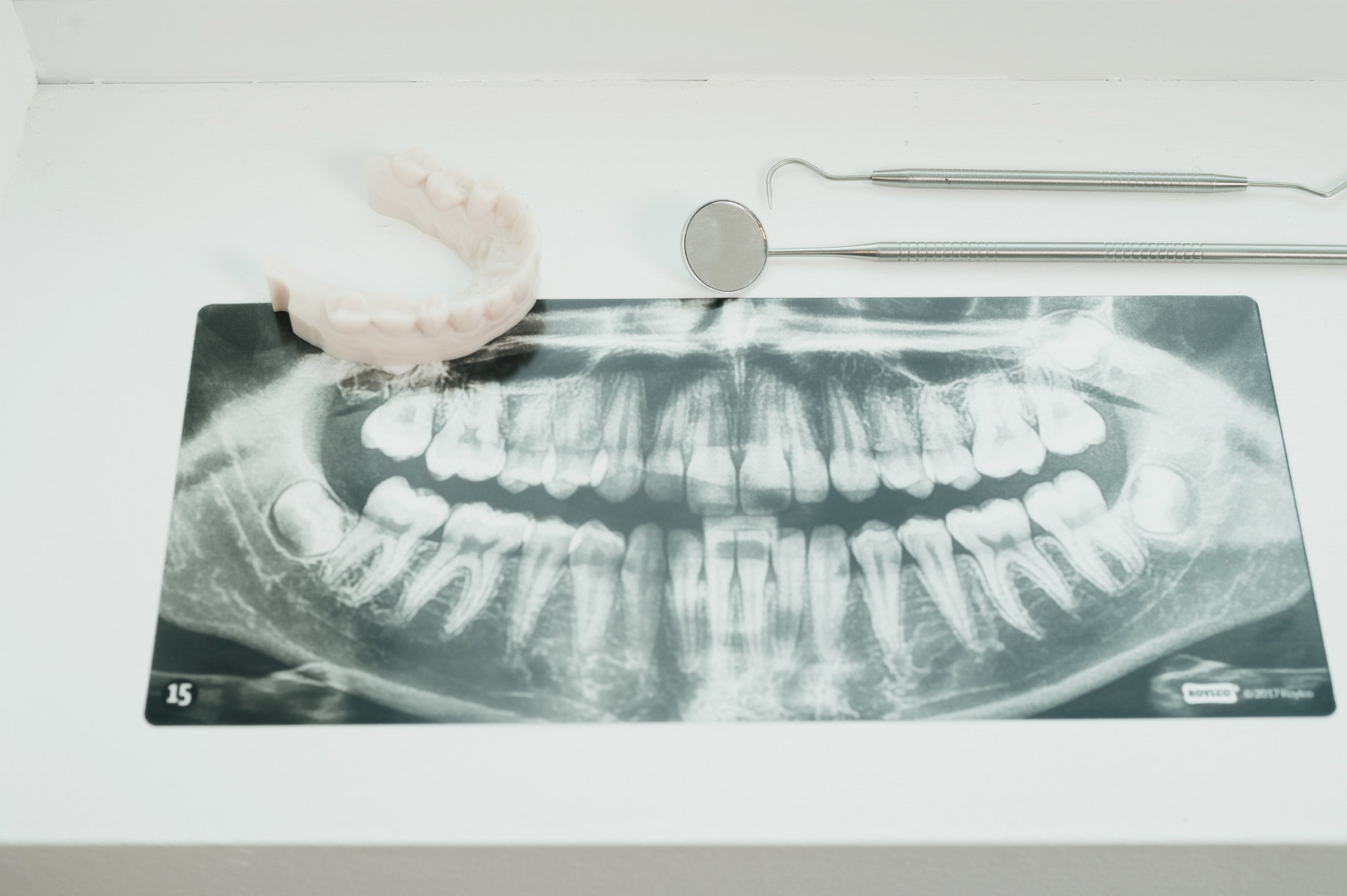 Dental panoramic X-ray showing full set of teeth with dental tools and a dental mold on a white surface.
