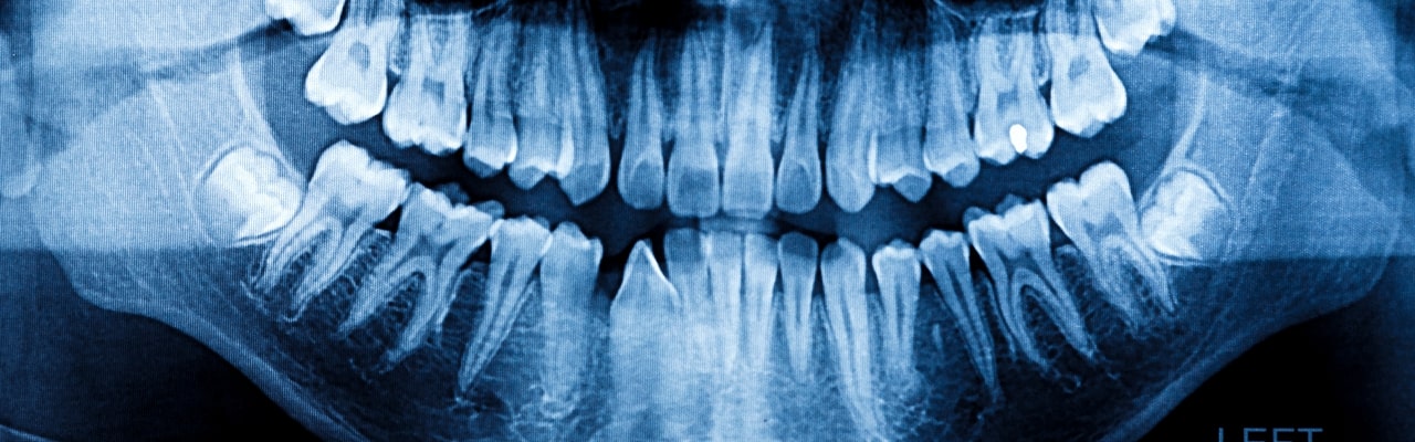 dental emergencies ashland OH