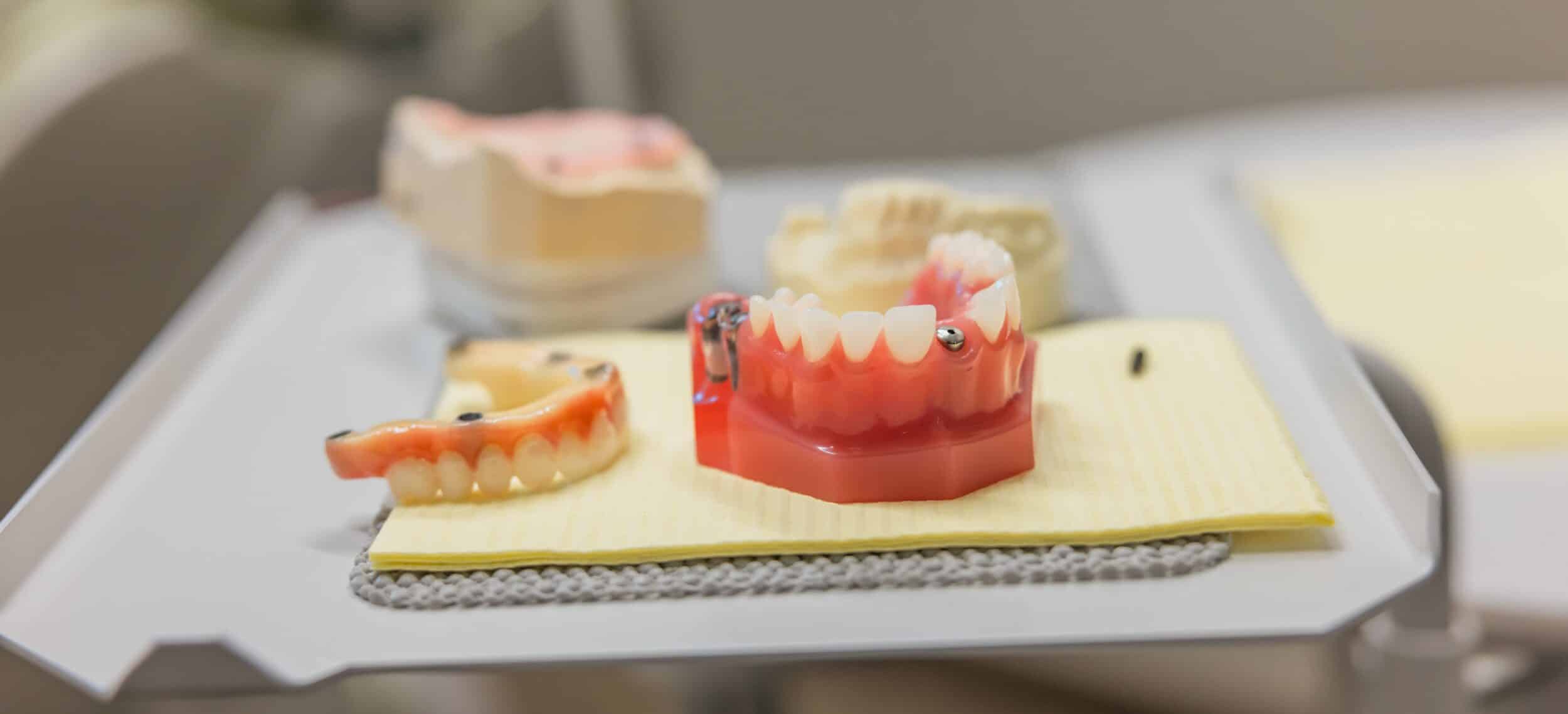 dental implants ashland OH