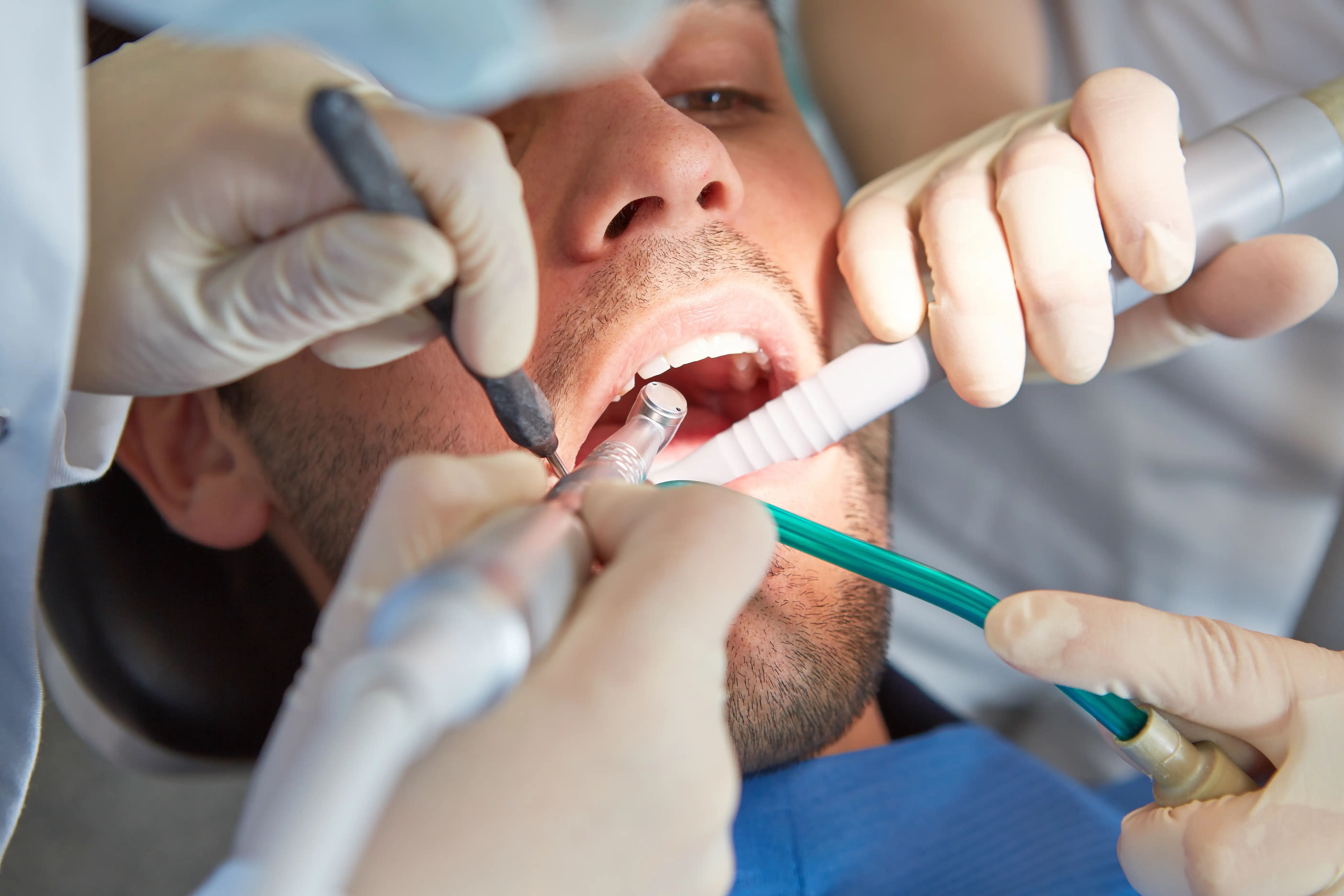Restorative Dentistry For St. Cloud: Rebuild Function, Strength, And Confidence