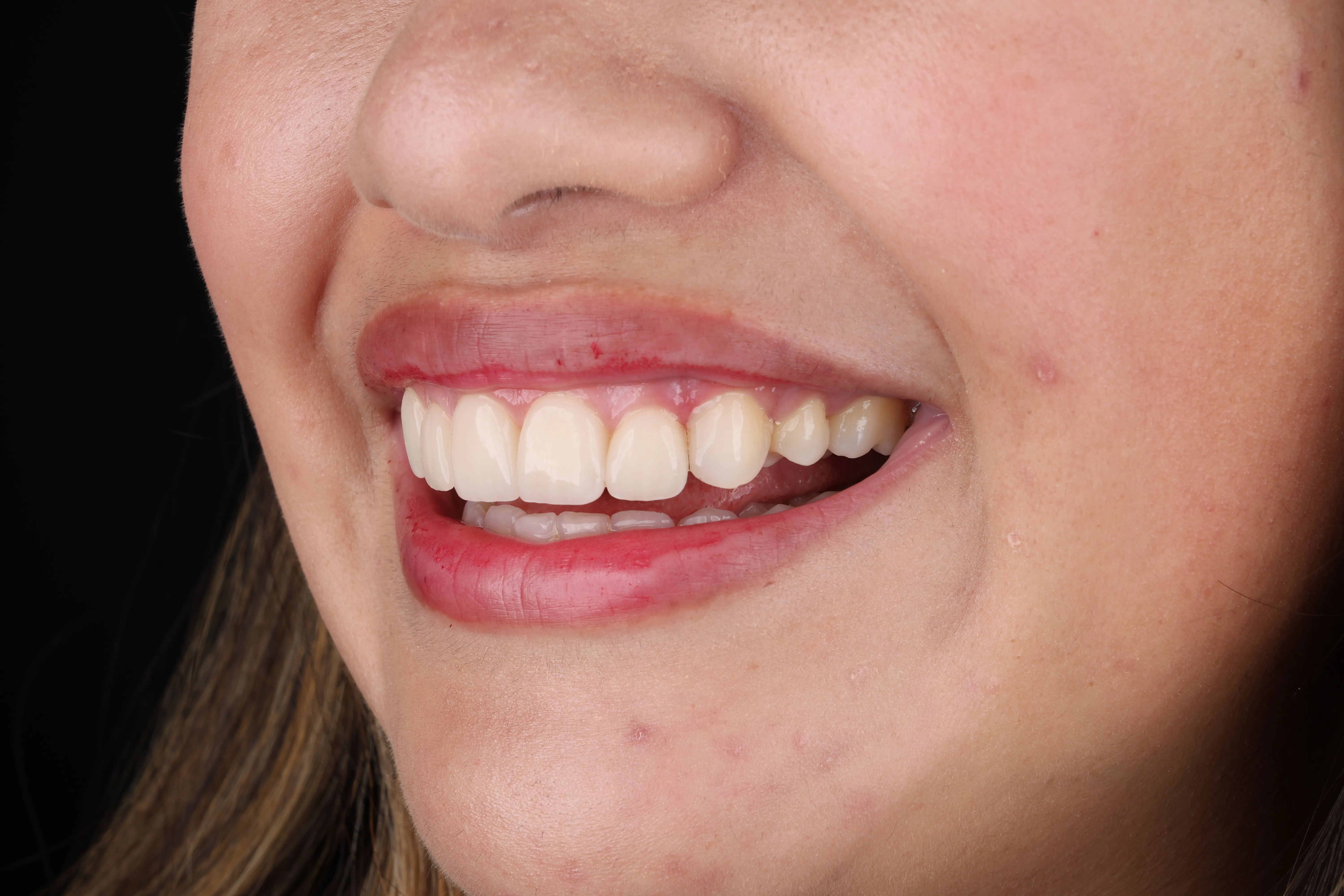 Restorative Dentistry For Doctor Phillips: Rebuild Function, Strength, And Confidence