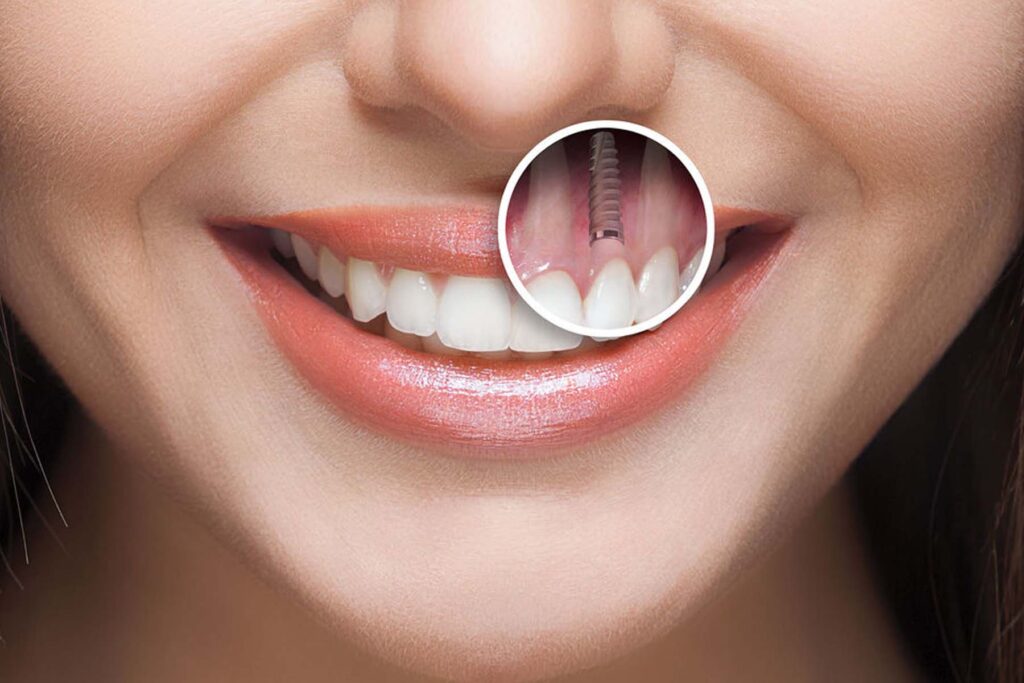 Why Lake Nona Patients Choose Makris Dental Prosthodontics