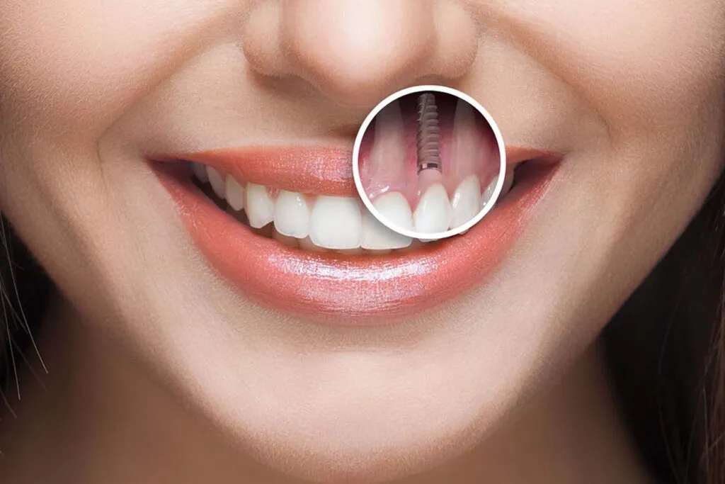 Why Lake Nona Patients Choose Makris Dental Prosthodontics