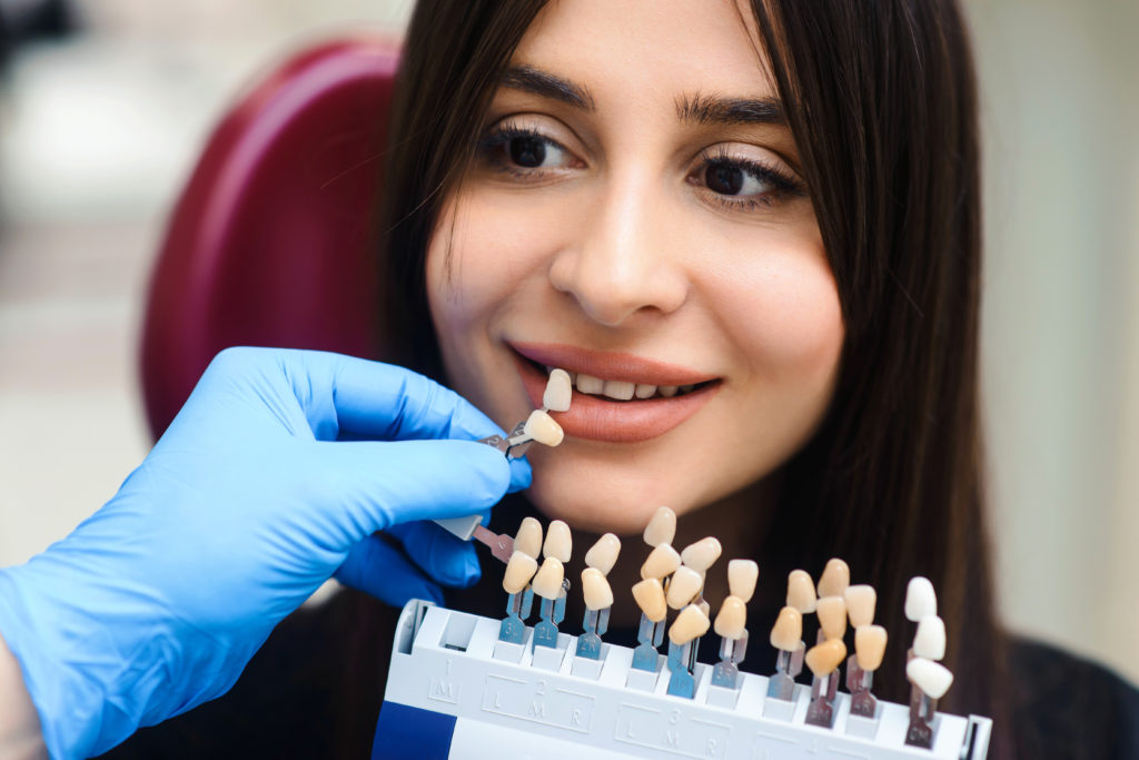 Traditional Veneers vs. No-Prep Veneers