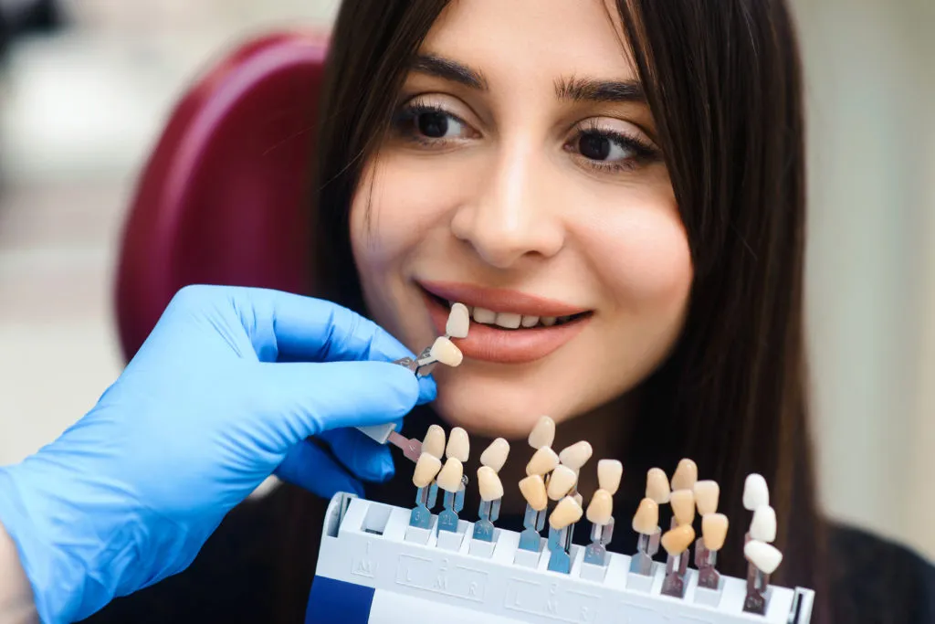 Traditional Veneers vs. No-Prep Veneers