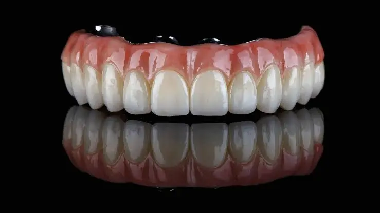 All-on-X Dental Implants in Lake Nona, FL