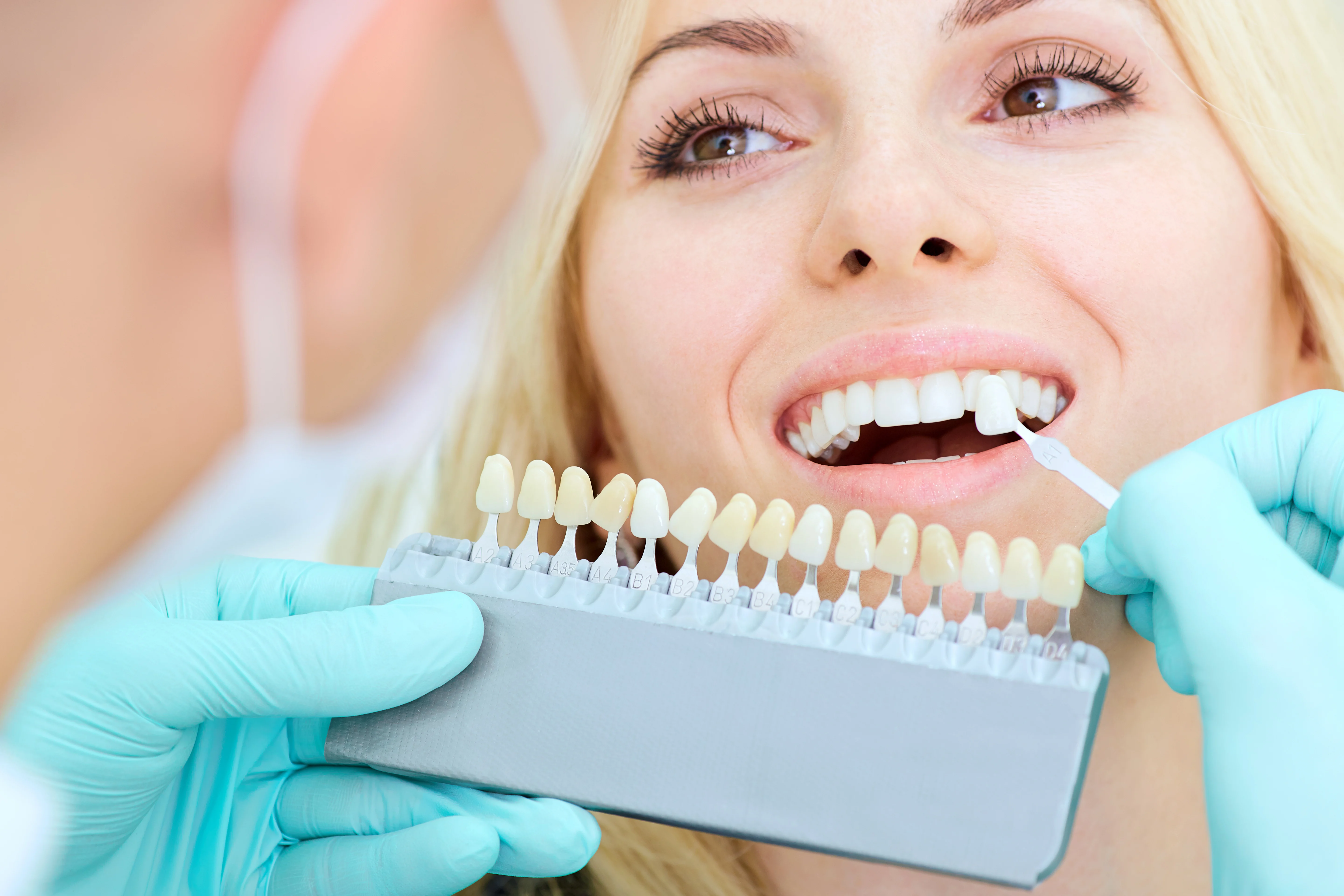 Professional Teeth Whitening in Lake Nona, FL