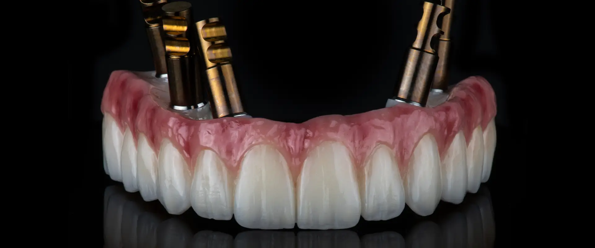 Dental Hybrids in Lake Nona, FL