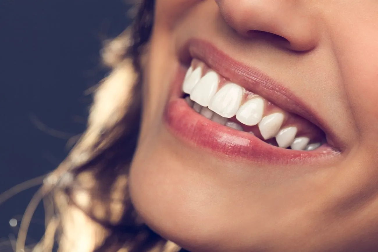 Custom Dental Crowns in Lake Nona, FL