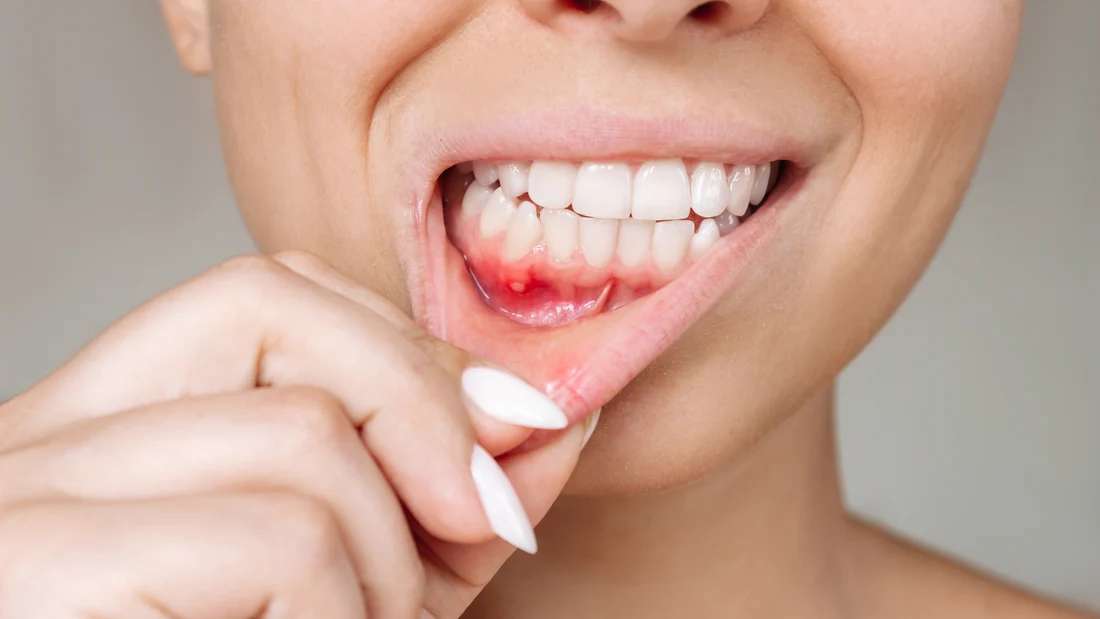 Personalized Gum Disease Treatment Options