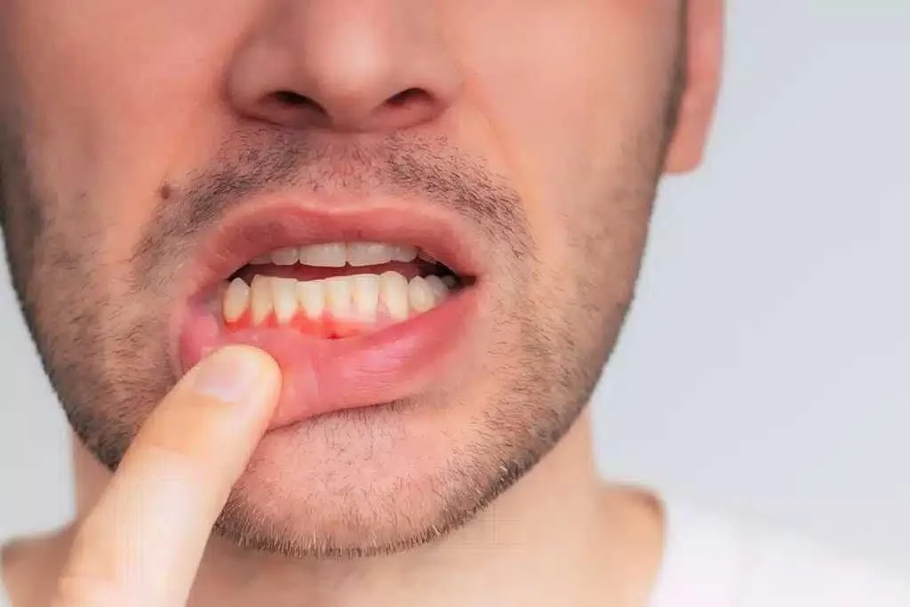 Signs You Should Schedule a Periodontal Evaluation