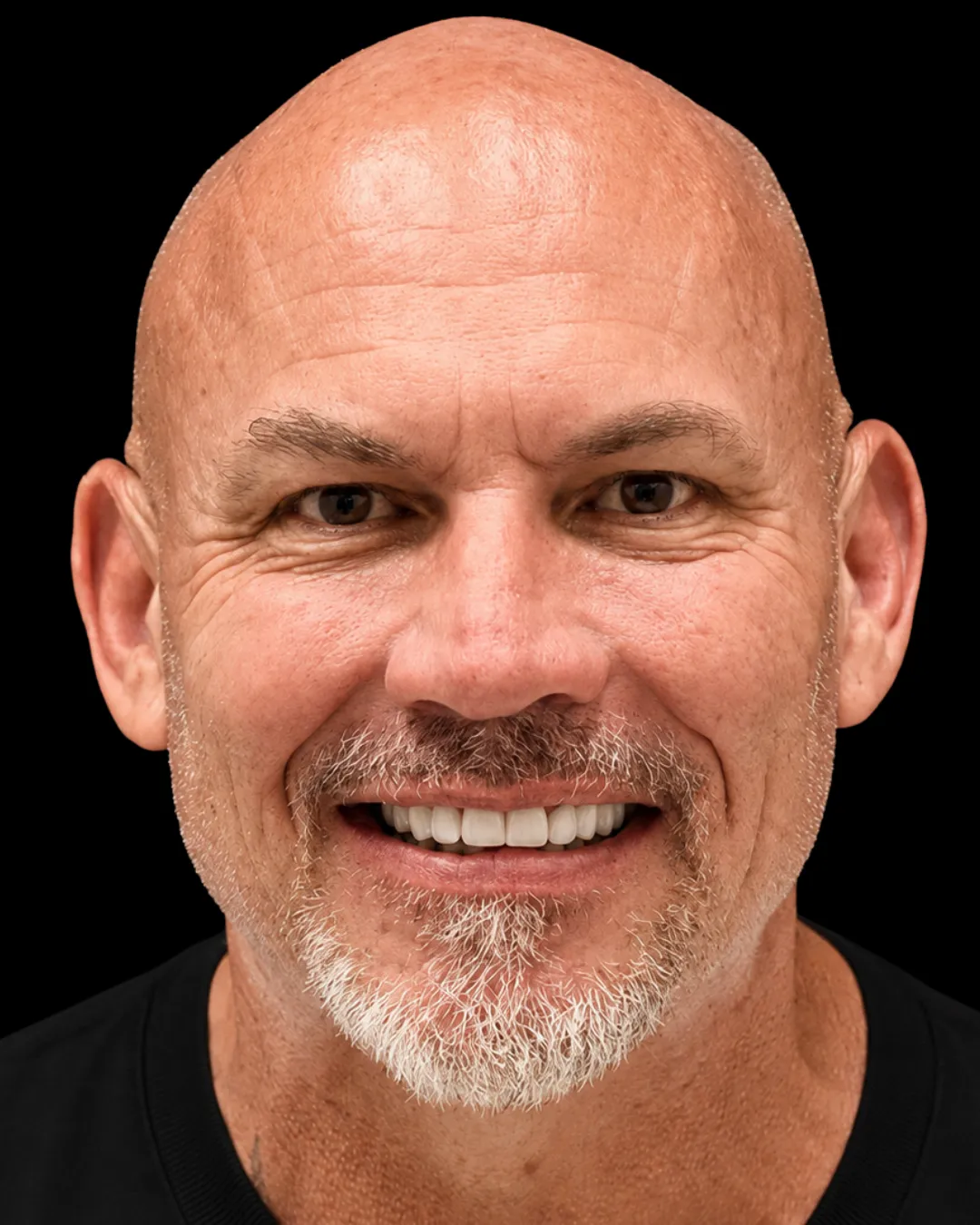 Richard smiling after treatment at Makris Dental Prosthodontics