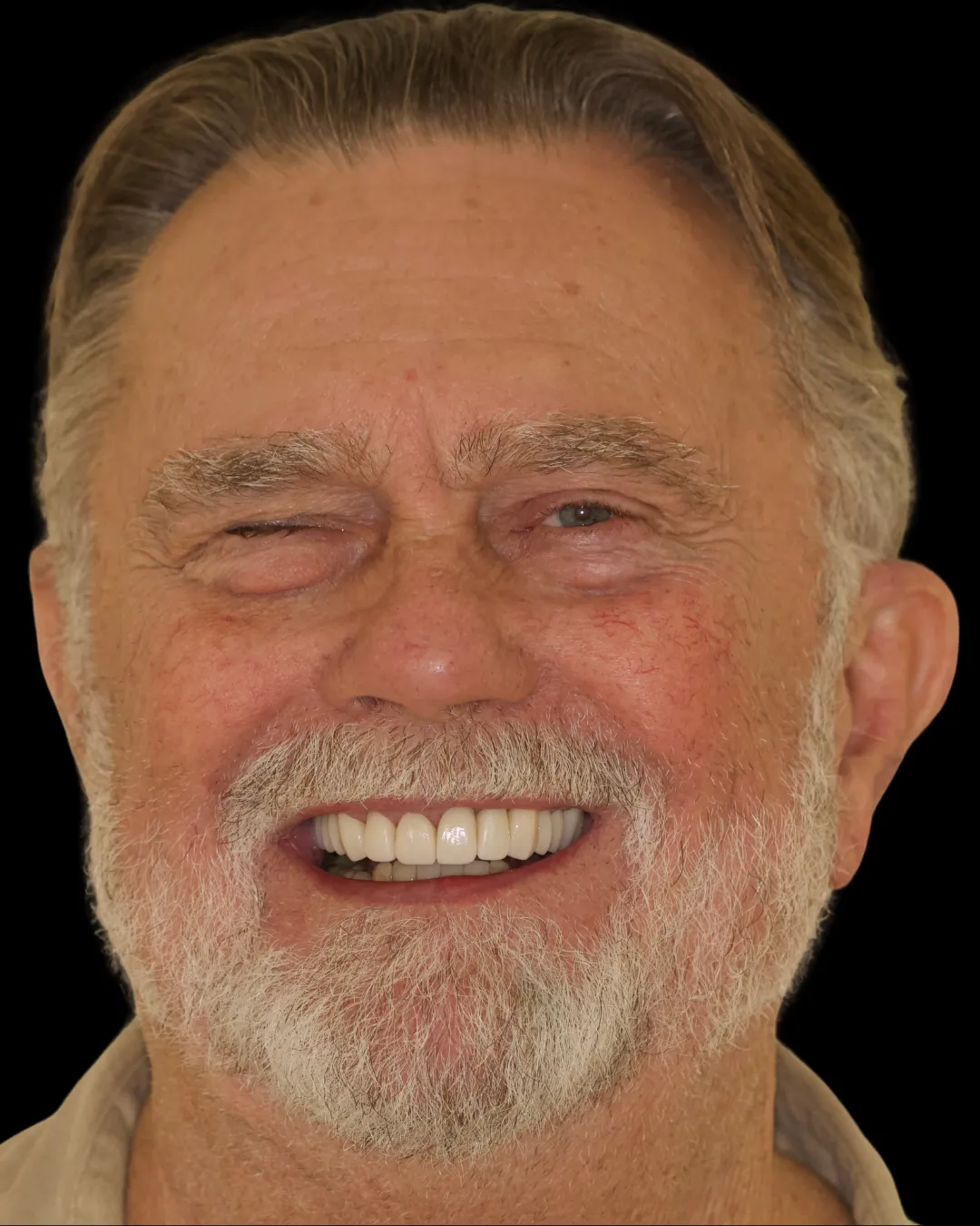 John smiling after treatment at Makris Dental Prosthodontics