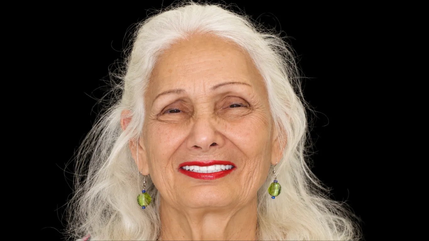 Teresa smiling after treatment at Makris Dental Prosthodontics