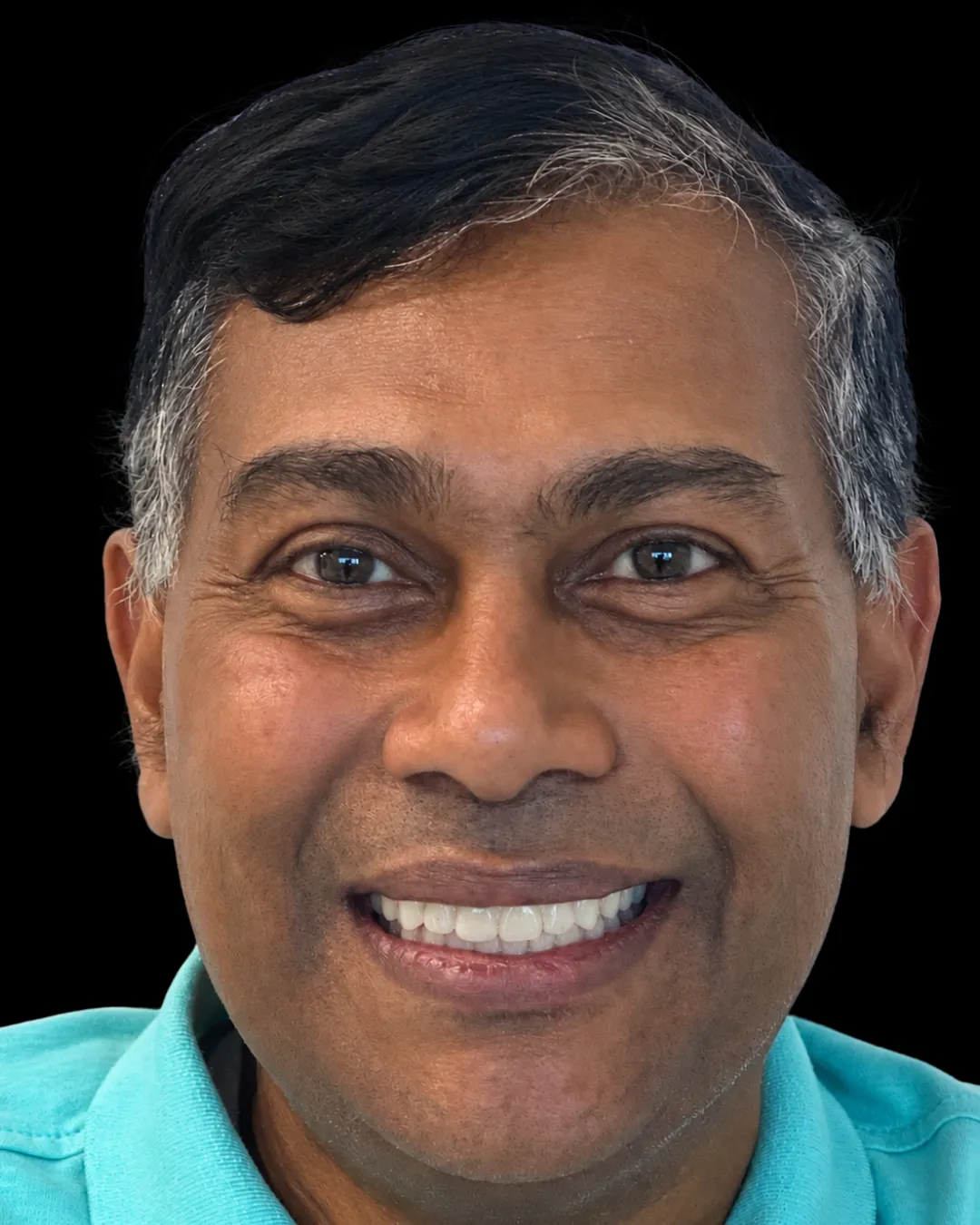 Tamesh after treatment, front view of the new smile