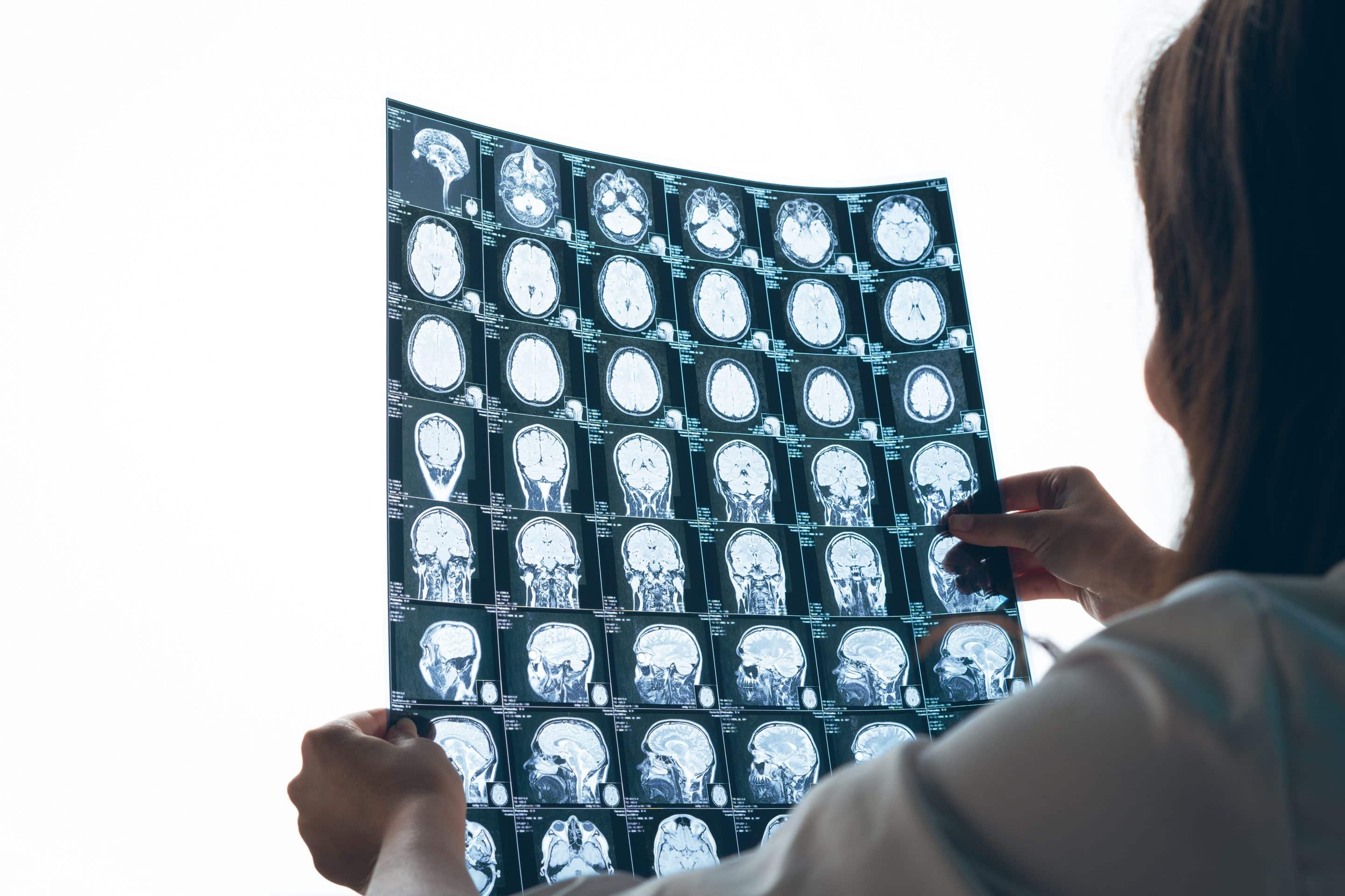 ibogaine-pipetting-potential-cure-for-brain-disorders