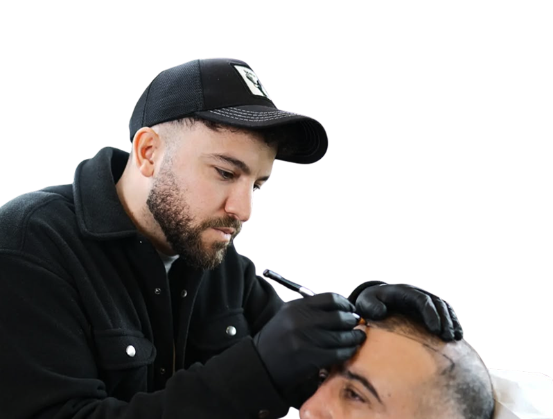 Mann mit schwarzen Handschuhen markiert Muster auf der Kopfhaut für Haarpigmentierung