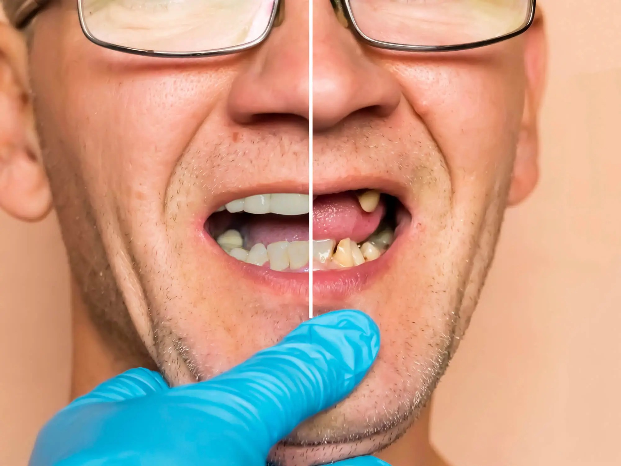 Before and After Restorative Dentistry with a Dentist in Prattville AL