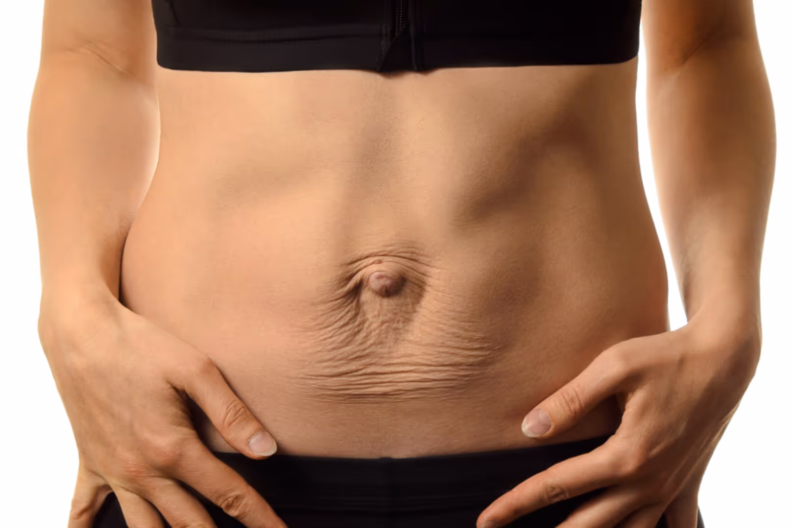 rozstęp mięśni prostych