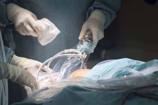 laparoskopowa operacja przepukliny