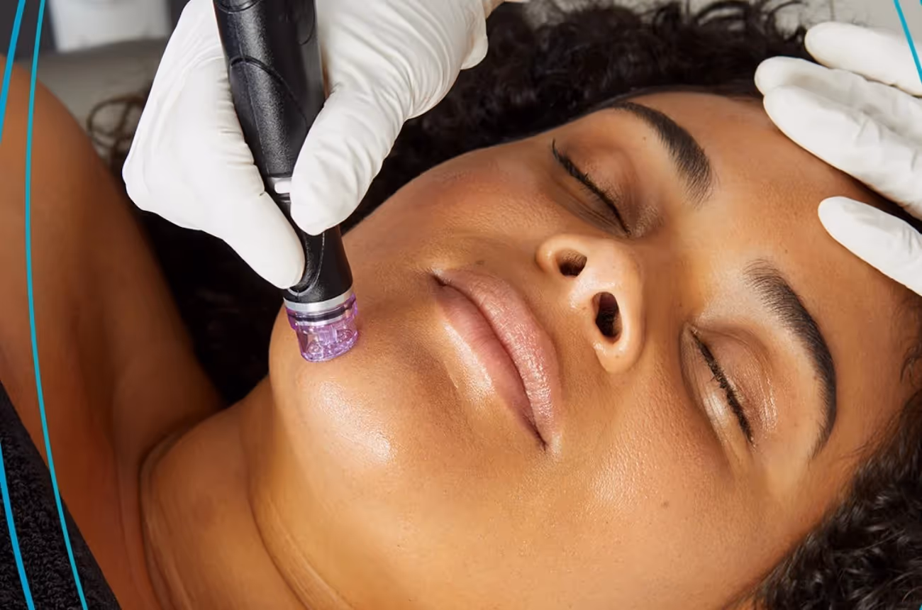 Moonlight Glow Hydrafacial Package of 3