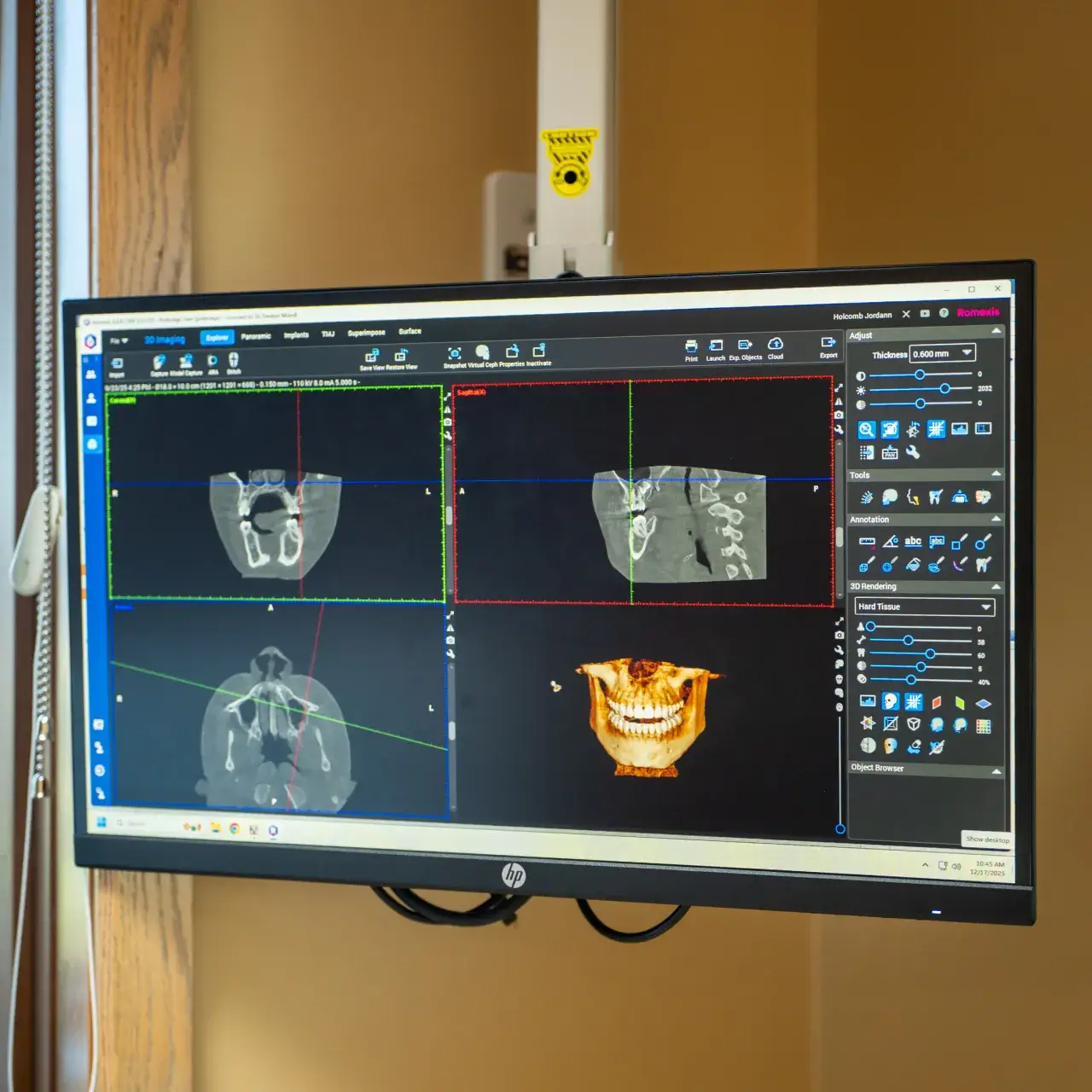 Dental Clinic Room of Hutchinson Family Dental  in Hutchinson, KS