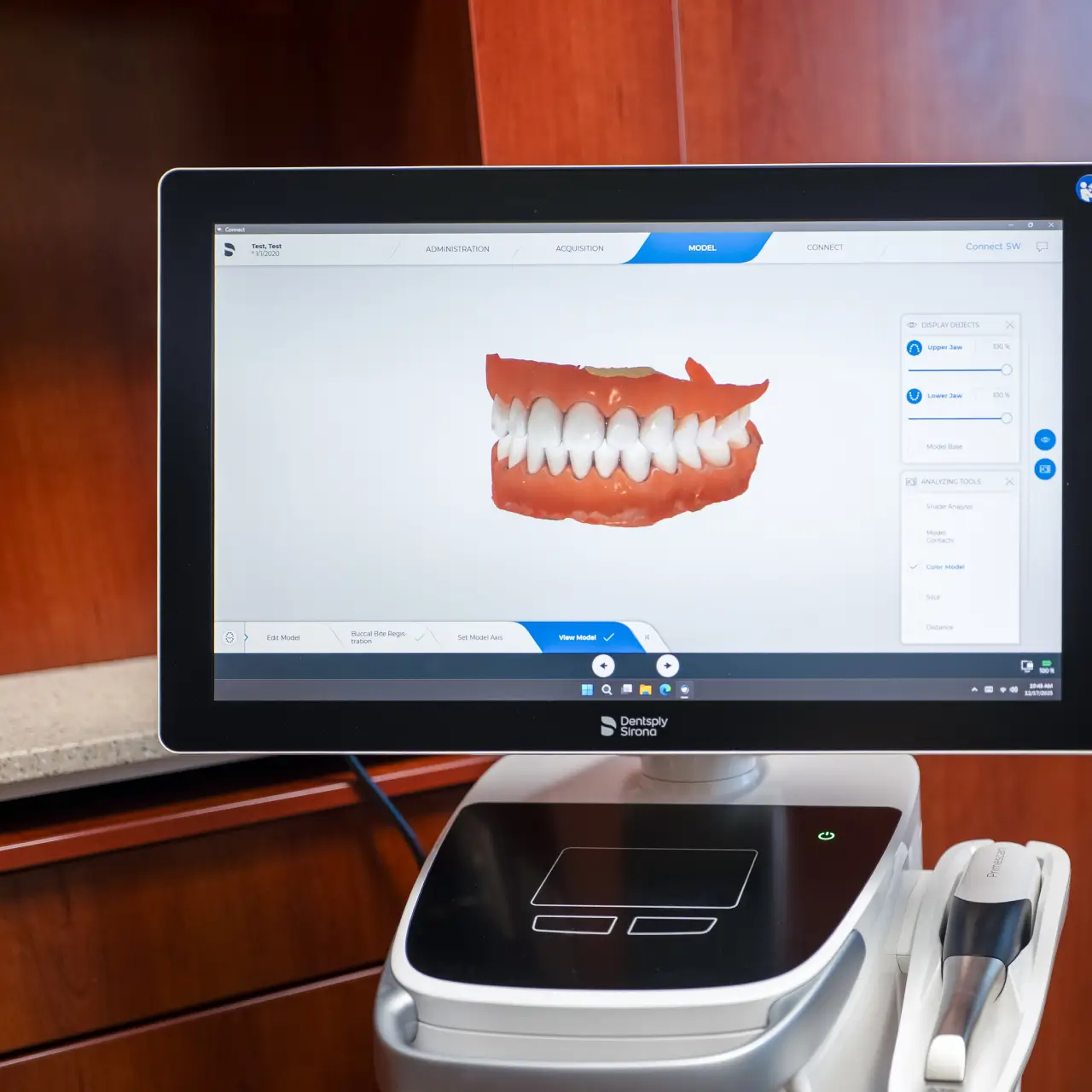 3d scan of a dental smile