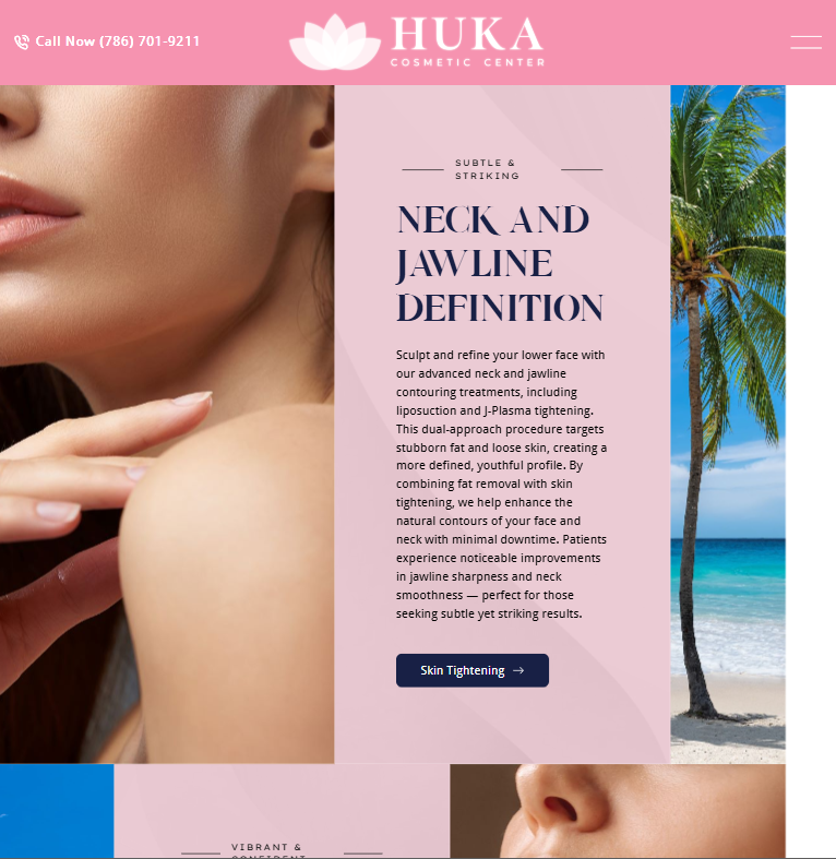 Gallery Single Image