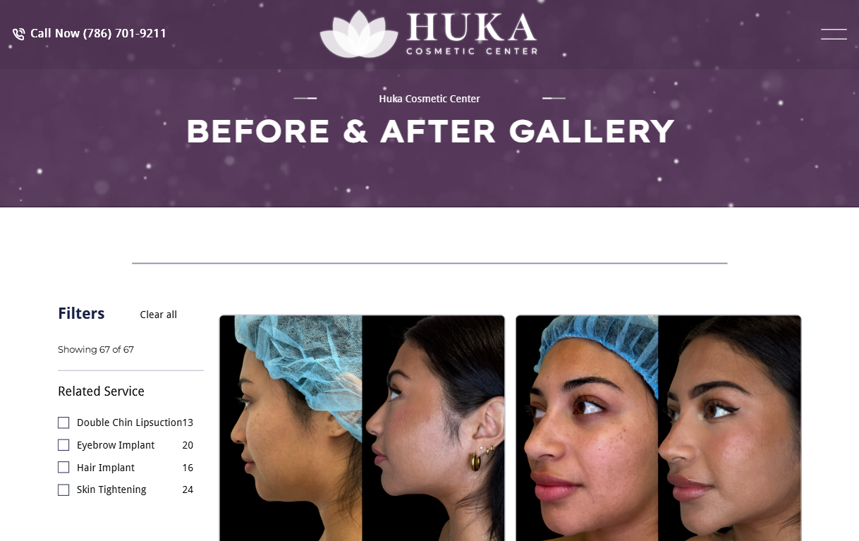 Gallery Single Image