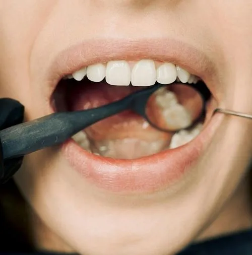 Dental examination with dental tools checking inside an open mouth