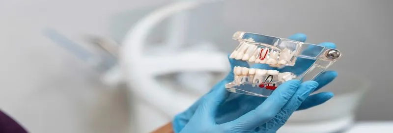 Dentist holding transparent dental model with blue gloves