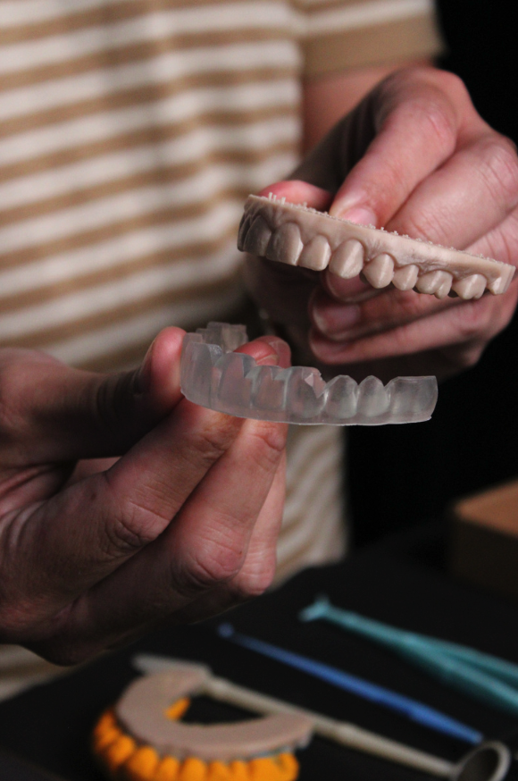 Hands holding clear and white dental impressions or mouthguards