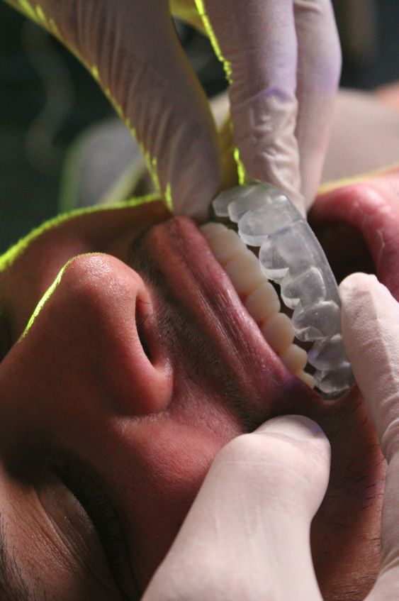 Dental professional examining teeth with transparent dental alignment tray