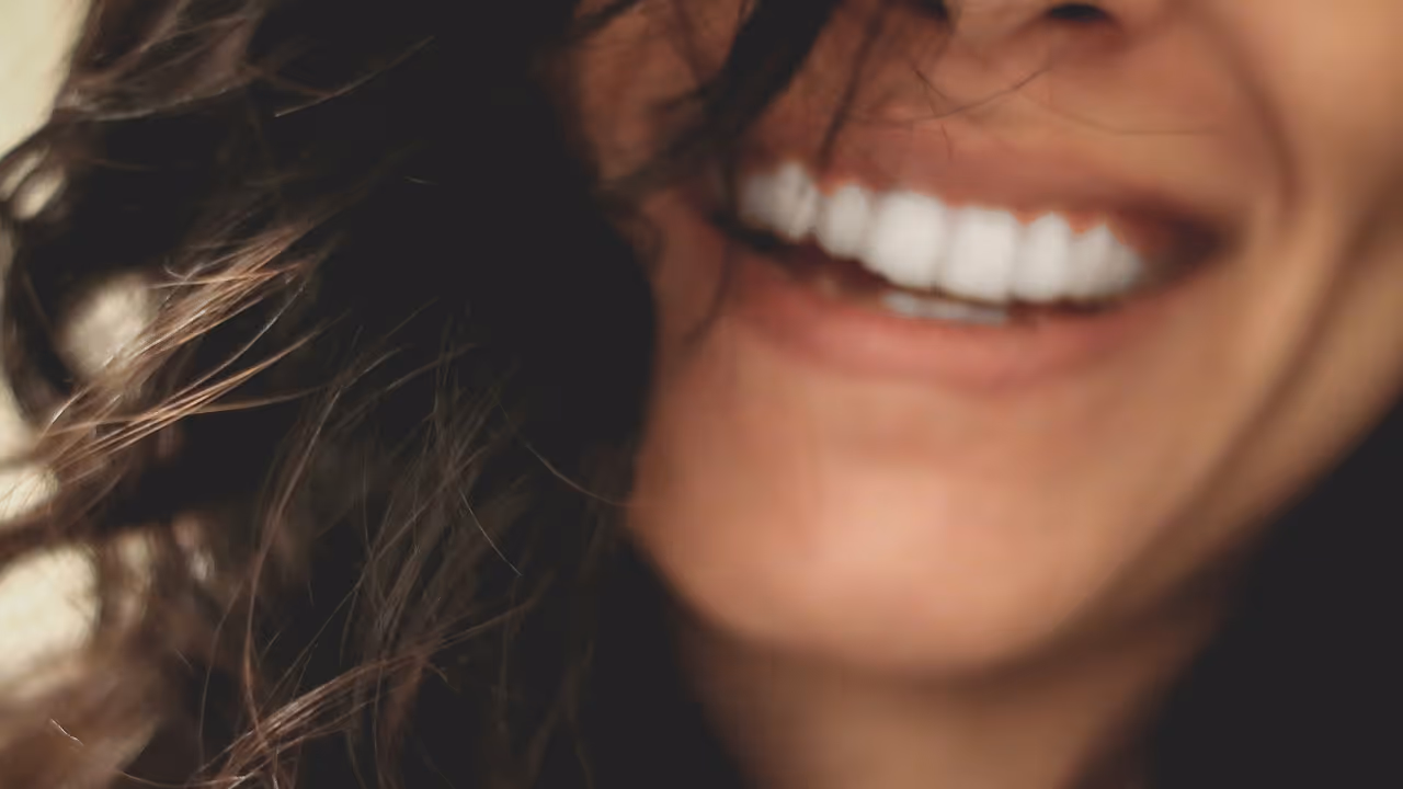 Smiling woman showing bright white teeth after professional whitening treatment.