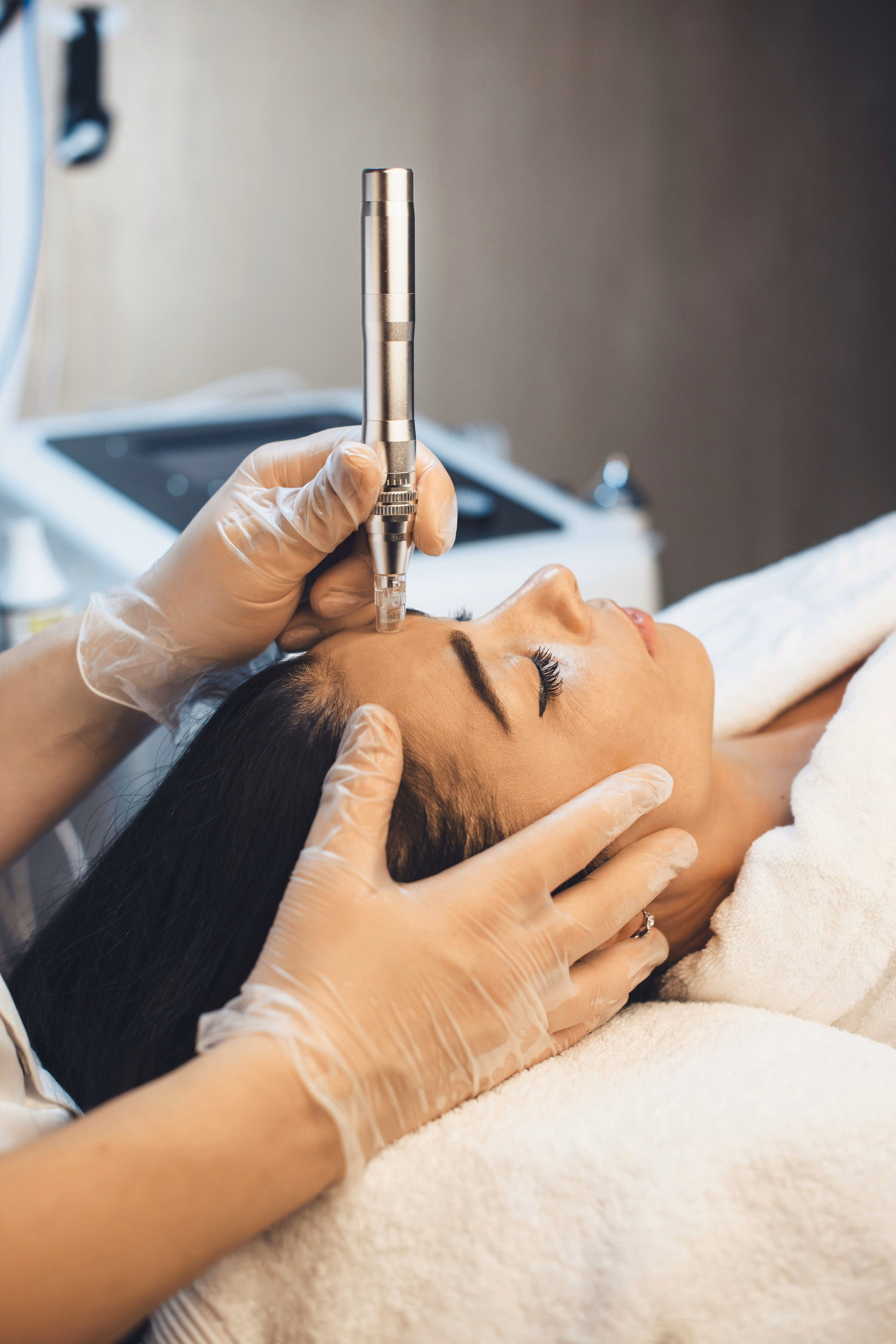 Woman receiving a professional microneedling facial treatment.