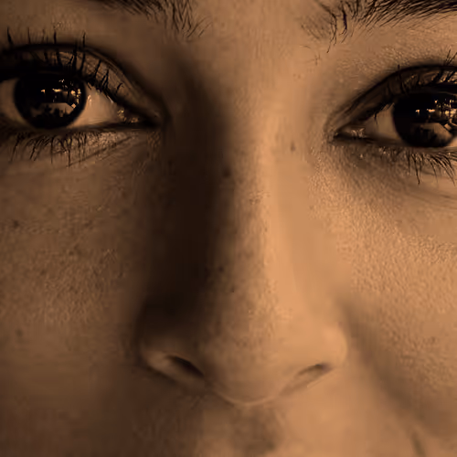 Close-up of a person's eyes and nose, showing skin texture and eye details.