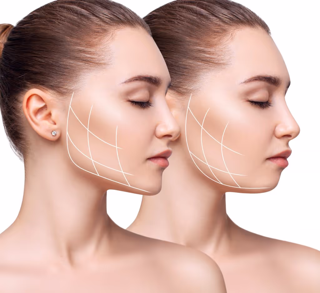 Two women with lines on their cheeks show concepts of cosmetic surgery or facial treatment.