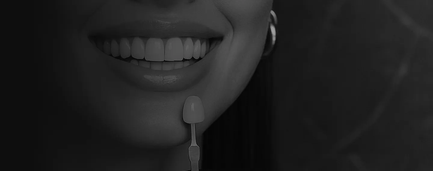 Schwarz-weiß-Aufnahme einer Frau mit hellem Lächeln während der Farbbestimmung für Veneers mittels Zahnfarbmuster