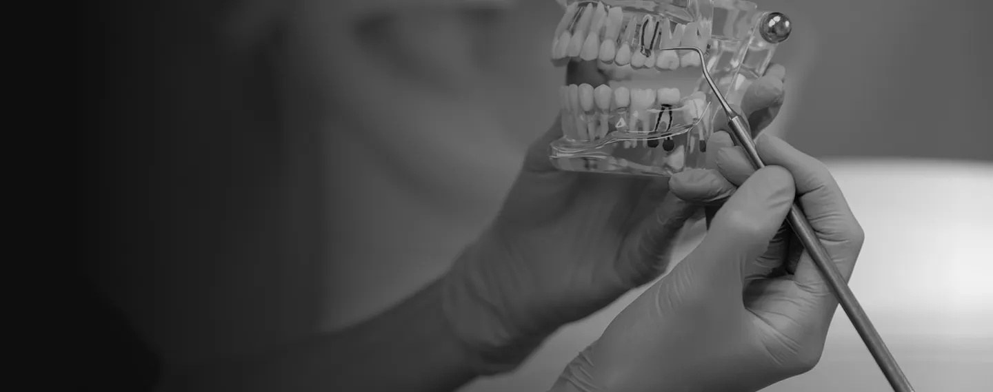 Schwarz-weiß-Aufnahme eines Zahnarztes, der mit einem Instrument die Zahn- und Wurzelstruktur an einem anatomischen Gebissmodell erklärt