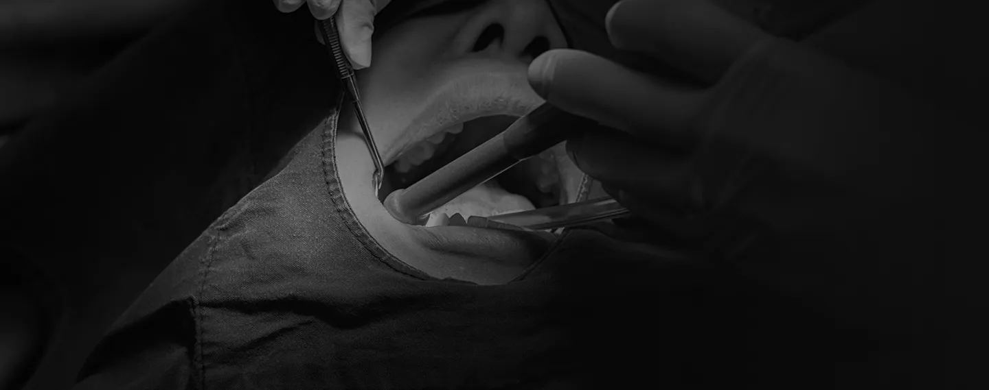 Schwarz-weiß-Aufnahme einer zahnärztlichen Behandlung unter OP-Bedingungen mit Instrumenten und Absaugung im Mundraum eines Patienten