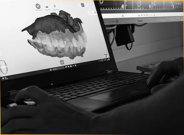 Schwarz-weiß-Aufnahme eines Zahnarztes, der auf einem Laptop ein digitales 3D-Modell eines Gebisses analysiert