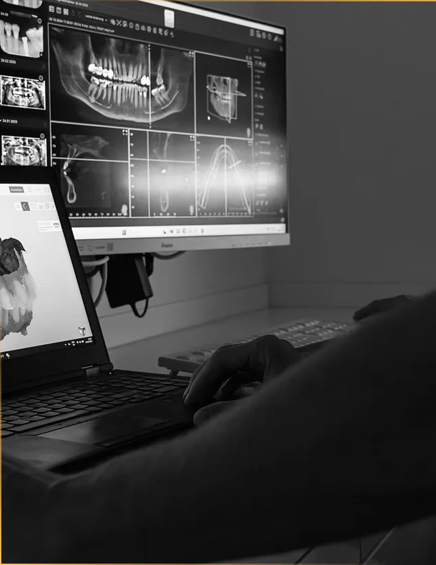 Schwarz-weiß-Aufnahme eines Zahnarztes, der digitale Röntgenbilder und 3D-Scans auf einem Monitor analysiert