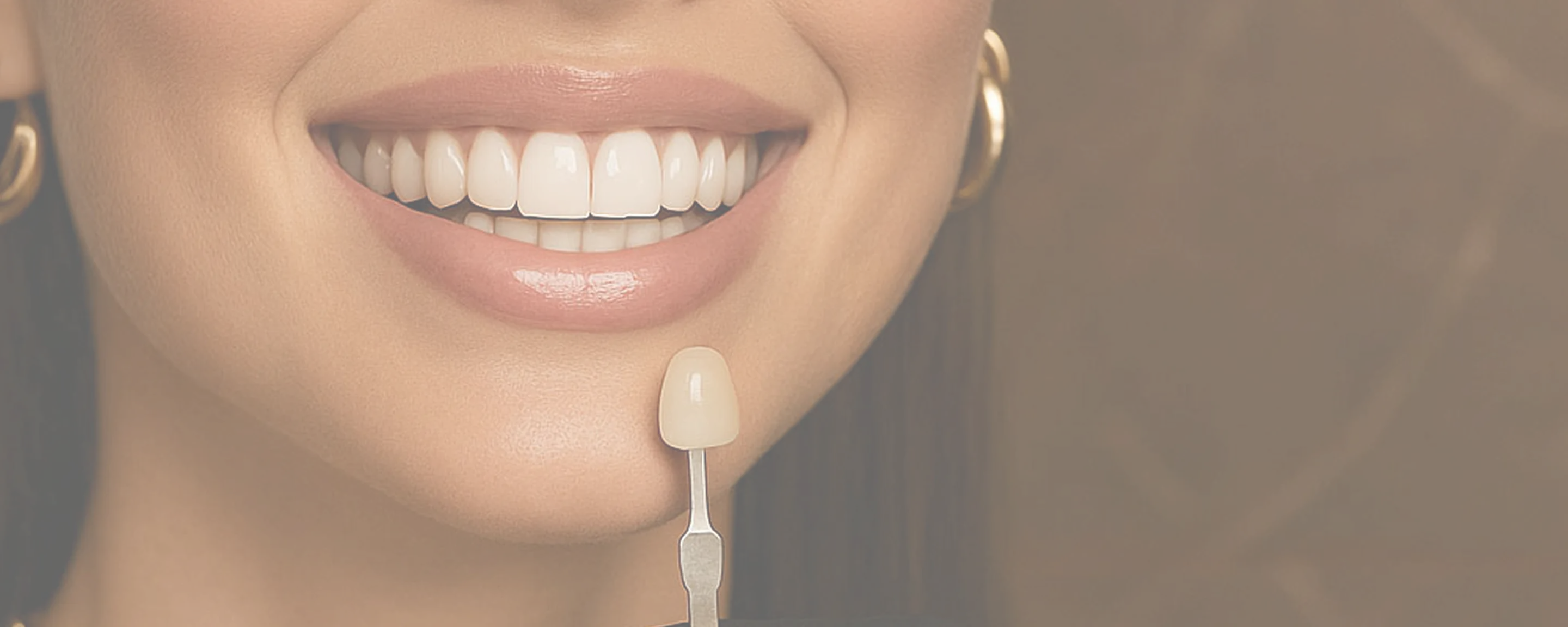 Frau mit hellem Lächeln während der Farbbestimmung für Veneers mittels Zahnfarbmuster